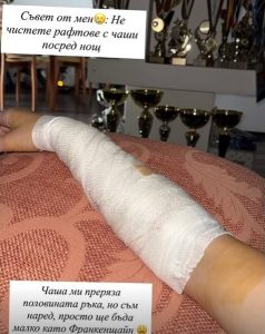 Александра Фейгин е с дълбока контузия след битов инцидент: „Ще бъда малко като Франкенщайн“