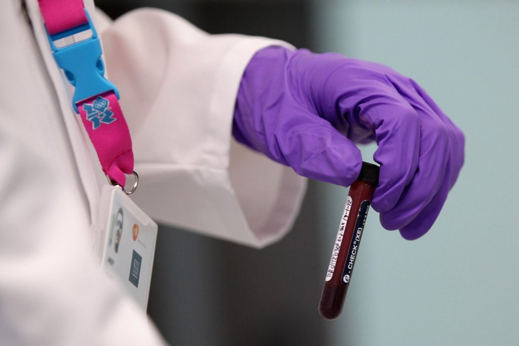 WADA отчете огромен успех: Конфискуваха 800 милиона дози допинг в Европа и затвориха 35 тайни лаборатории WADA отчете огромен успех: Конфискуваха 800 милиона дози допинг в Европа и затвориха 35 тайни лаборатории