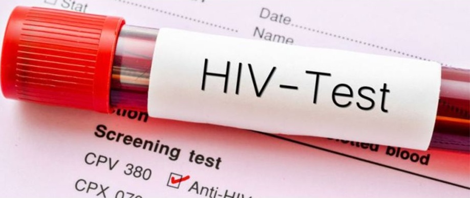 Късната диагноза на ХИВ остава сериозен проблем в Европа, застрашавайки целите за 2030 г.