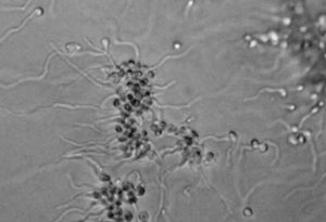 Чернобилска плесен – източник на надежда за космически пътешествия и защита от радиация