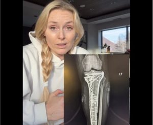 Линдзи Вон разкри: Личният ми лекар спаси крака ми от ампутация