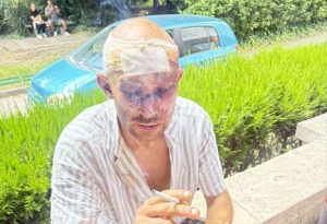 Непълнолетен е задържан след тежък побой над мъж в центъра на Варна
