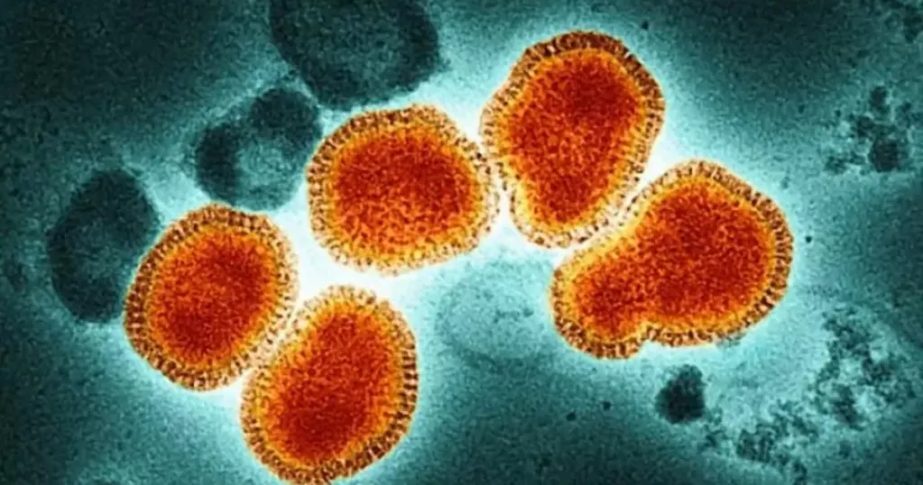 Лаборатория откри първия грипен A(H3N2) за сезона у нас