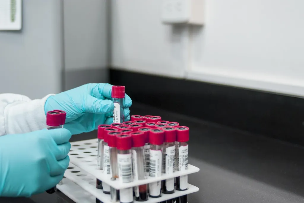 Откриха първия за сезона вирус A(H1N1)pdm09 при пациентка в София