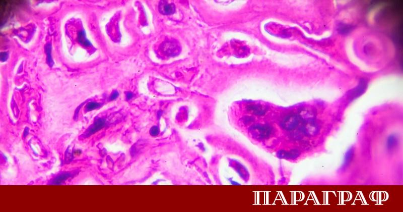 Случаи на проказа са регистрирани в Хърватия и Румъния Един