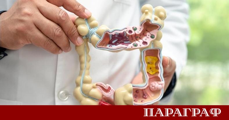 Ракът на дебелото черво заема тревожното трето място сред онкологичните