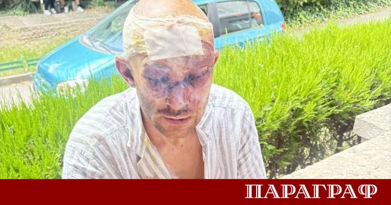 36 годишният Румен Александров се намира в критично състояние в