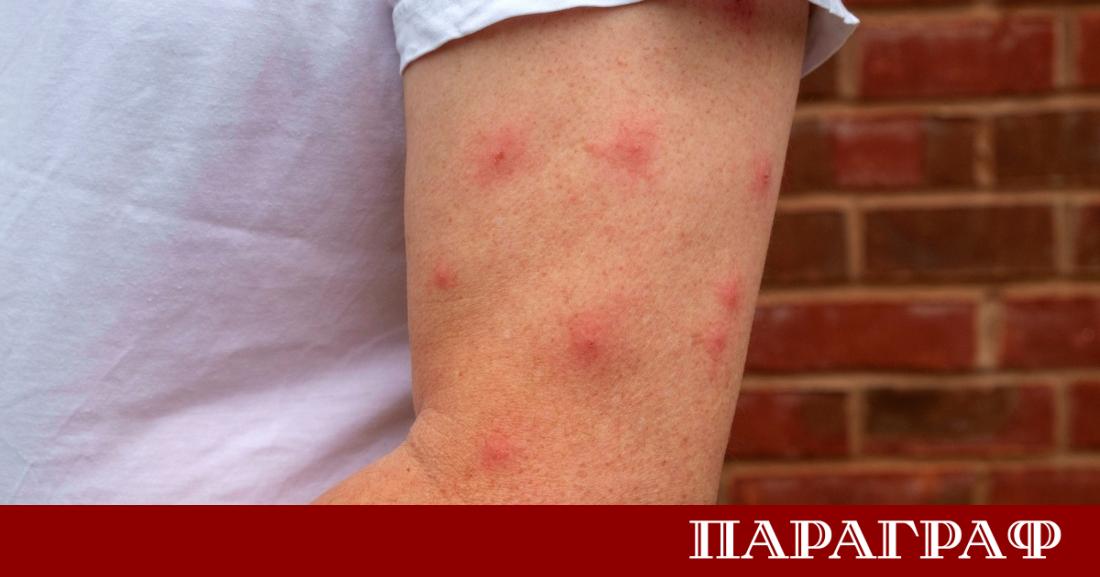 Тропическите заболявания вече не са екзотична заплаха само за далечните